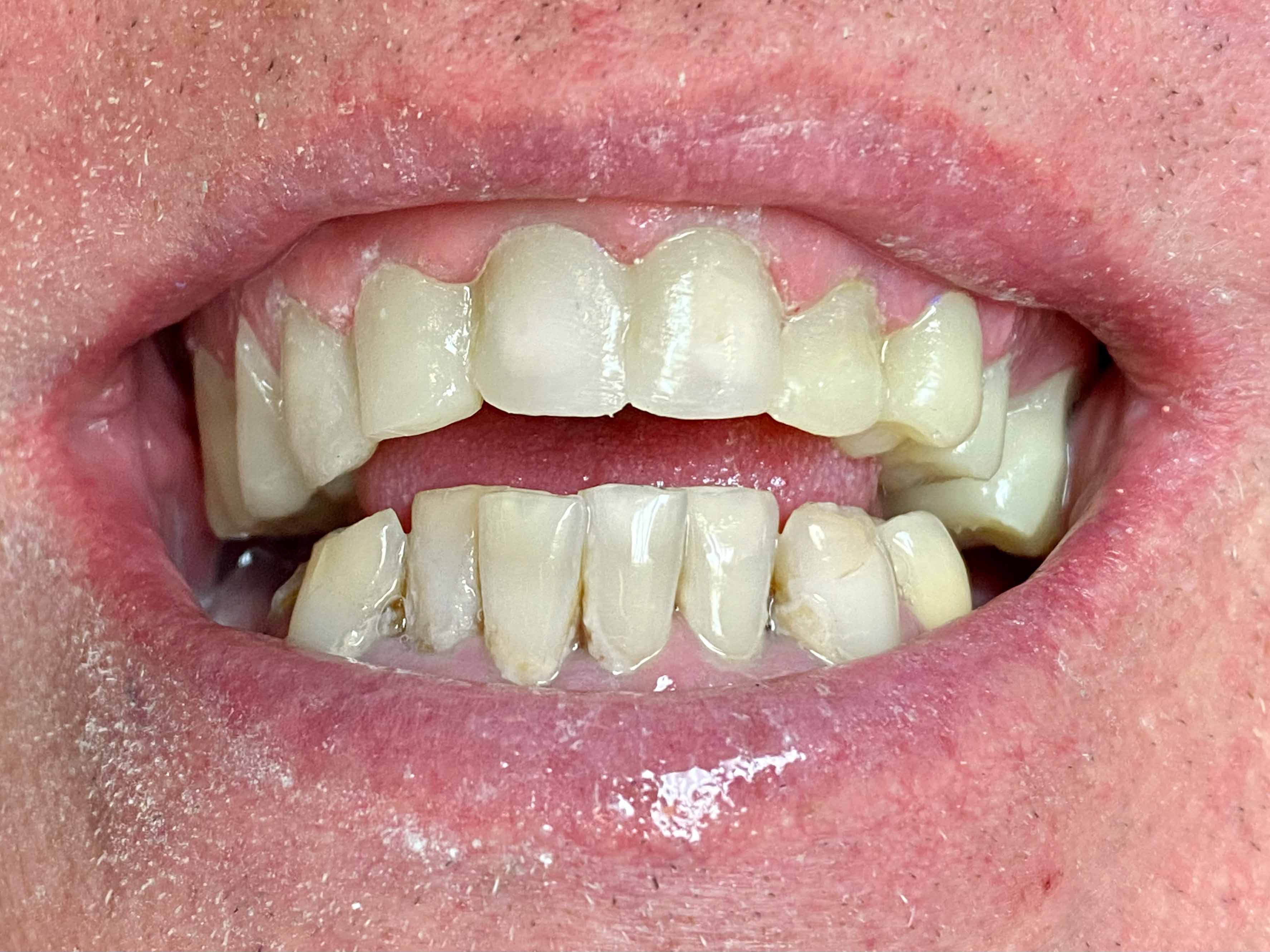 Colorado Springs Dentist Tuttle Family Dentistry